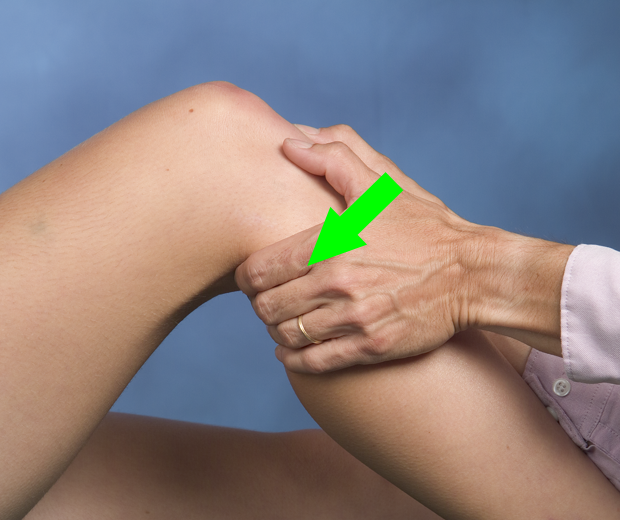 The “Other” Cruciate Ligament, AKA PCL