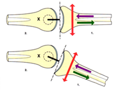 When Convex-Concave Rule Meets Clinical Practice