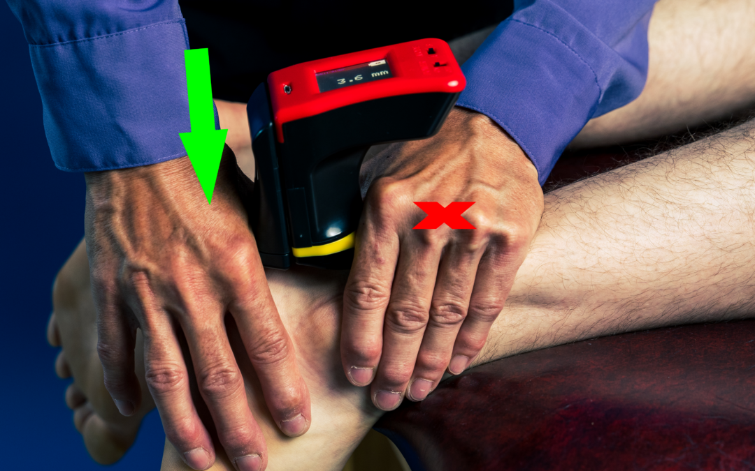 Not All Ankle Sprains Are Equal